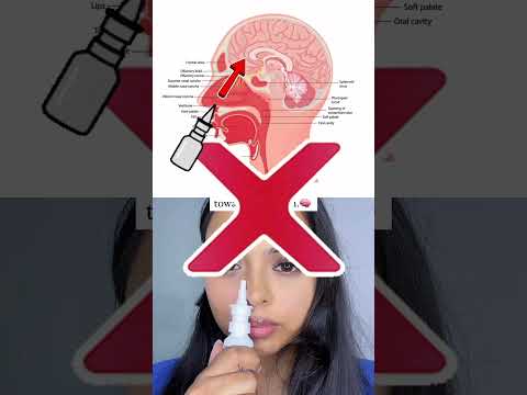 How to use nasal spray correctly? #nasalspray #health #medicine #lifehacks #fyp #viralshorts