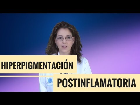 HIPERPIGMENTACIÓN POSTINFLAMATORIA
