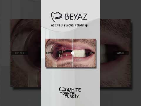 Klinik videolarımızı izleyin