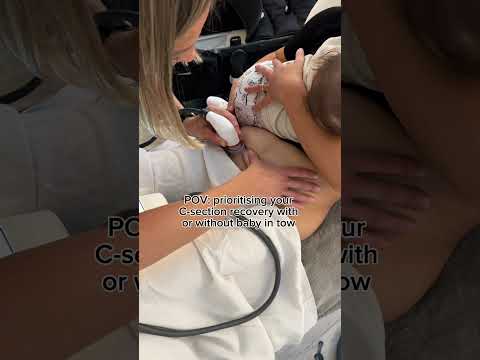 C-section recovery with @LymphaTouch #csectionrecovery #newmum #newmom #postpartum