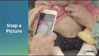 Experience VisualDx AI: Unlock the Power of AI to Support Dermatology Care