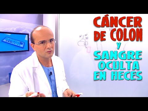 Colon Cancer and Fecal Occult Blood Test for Diagnosis - Cancer #12