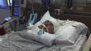 Eels - After the Operation