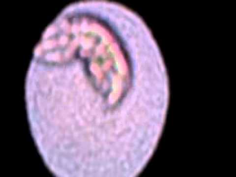 Urine Schistosoma 2