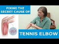 Fixing The Secret Cause of Tennis Elbow [Non-Surgical Arm Pain Specialist - Denville, NJ]