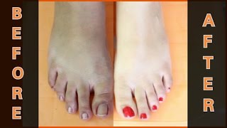 FEET WHITENING PEDICURE (at home) - Remove SUN TAN