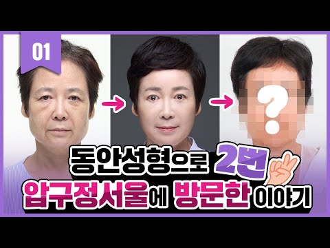 #주름성형 압구정서울성형외과 2회차 방문