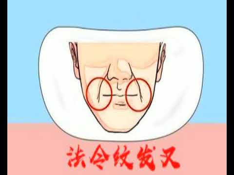 法令紋分叉