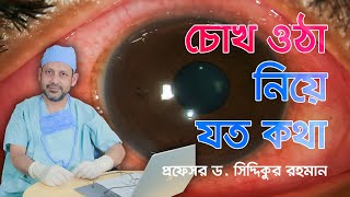 সমসাময়িক চোখ ওঠা | CONJUNCTIVITIS || Prof. Dr. Siddiqur Rahman | Glaucoma Specialist & Surgeon ||