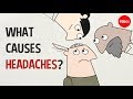 What Causes Headaches Dan Kwartler
