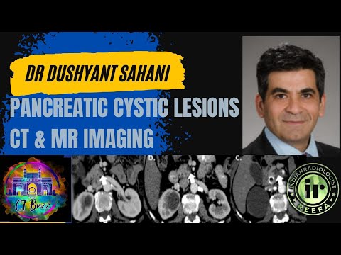 PANCREATIC CYSTIC LESIONS | DR DUSHYANT SAHANI | IPMN | MRI IN PANCREAS