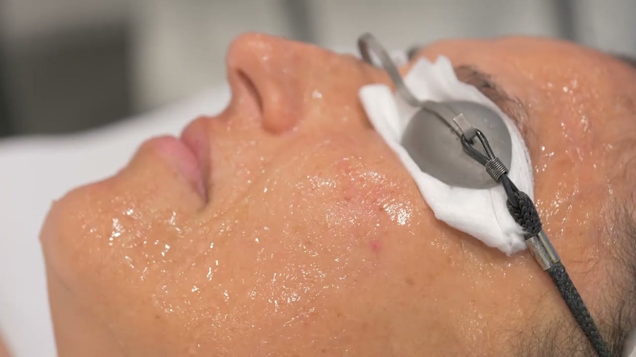 La Dra. Raquel Andreu explica las claves y beneficios de la luz pulsada intensa (IPL)