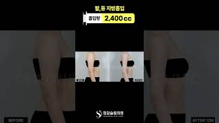 혹시 결혼 준비하세요? #팔뚝살빼기