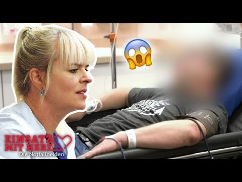 3.7 per mille blood alcohol level! 😱 The patient drinks 2 bottles of vodka in the morning! | A he...