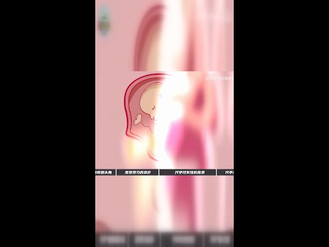 28万竟买来一个子宫？记者暗访揭露惊人内幕