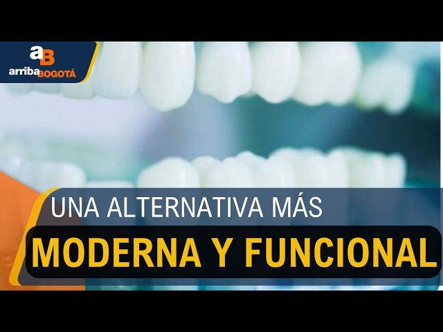 Implantes dentales, la opción más recomendada para reemplazar dientes perdidos 