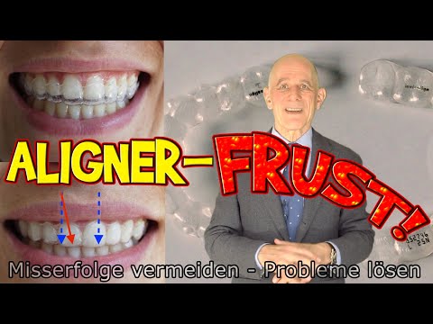 Aligner-Frust: Troubleshooting und Krisenmanagement wenn's mit Ihrer Zahnspange nicht richtig klappt