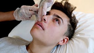 Getting LIP FILLERS For The First Time!