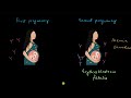 Rh Blood Group System Body Fluids And Circulation Biology Khan Academy