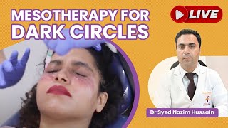 🔴 Live 😱 | Get Rid of Dark Circle using Mesotherapy, Causes & Treatment✅ | Royal Lush Clinic | Delhi