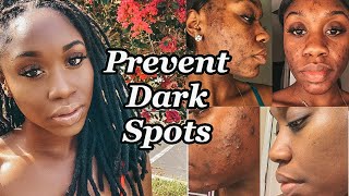 SKIN | How to Remove and Prevent Hyperpigmentation (Dark Spots) | Shanese Danae