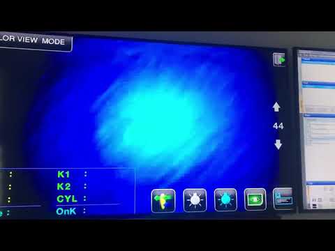 BLANCA CECILIA BOHORQUEZ CORNEAL CERO