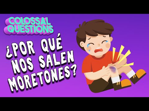 ¿Por qué nos salen moretones? | PREGUNTAS COLOSALES