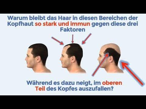 Wo Blutegel auf Prostata setzen Kann es von Prostatitis unvollendet Geschlechtsverkehr