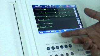 عرض توضيحي مباشر لجهاز ECG 1112M من كيرويل