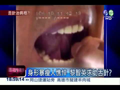 黎智英失智? 傳做舌針治療