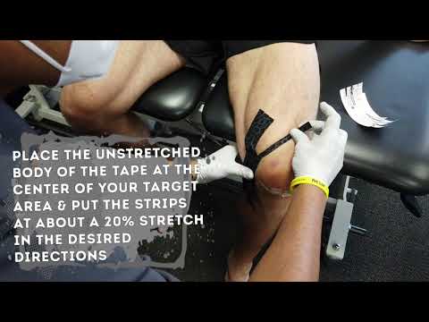 Spider Kinesiology Taping to Improve Swelling Post Knee Surgery