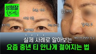 40대 이상 필수 시청! 중년 얼굴 변신 리포트 A →Z 완벽 분석! 보이지 않는 원인부터 해결해야 합니다 | 케이스 리뷰 : 코+이마거상술 | 에디션성형외과X한대희원장