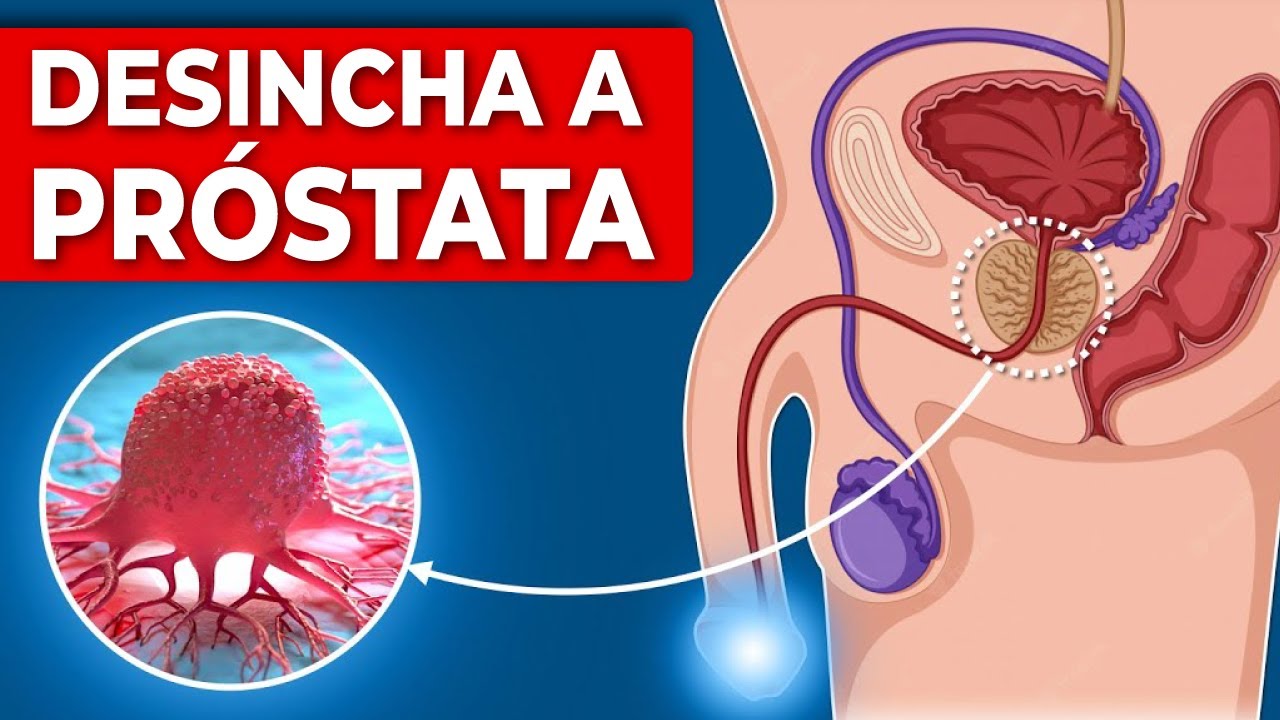 Coma essas frutas todos os dias para diminuir o tamanho da próstata