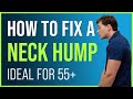 How To Fix A Neck Hump In 3 Simple Steps For 55