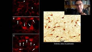 Sistemas Neuromoduladores Parte 5 - Acetilcolina (16/9)