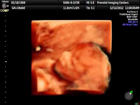 The Wonder Within You Week 19