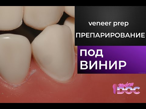 Препарирование под виниры