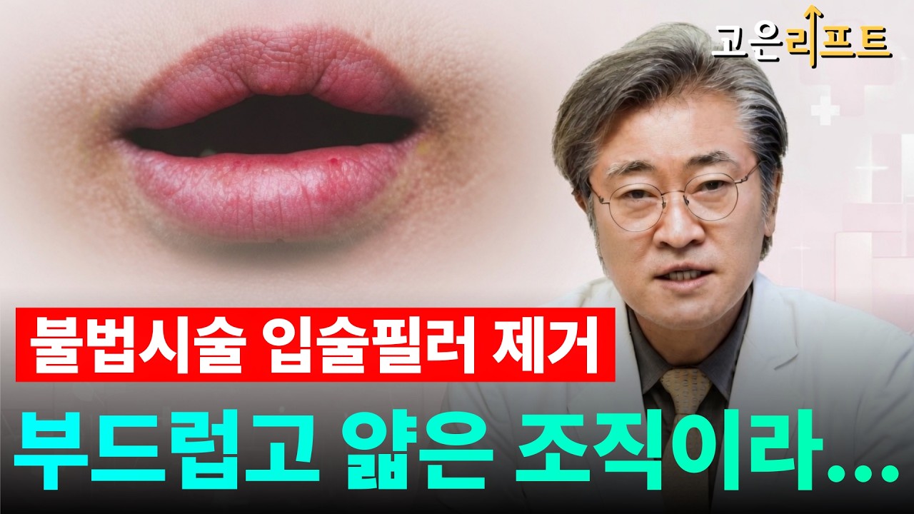 고은리프트 입술 이물질 제거 유튜브 영상