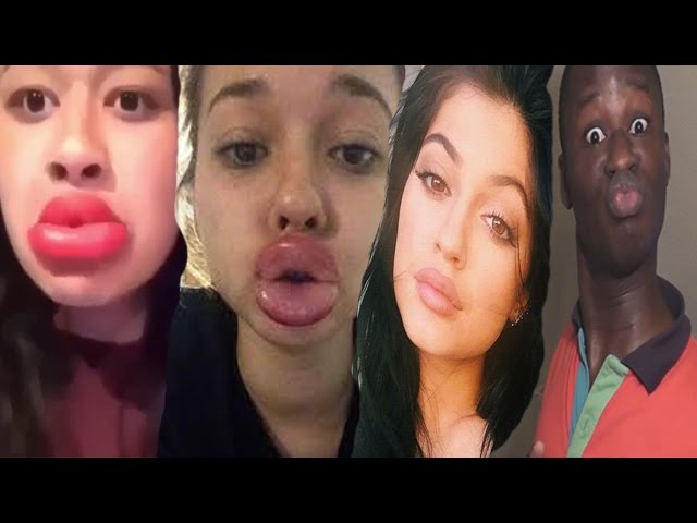Kylie Jenner Lip Challenge Reaction