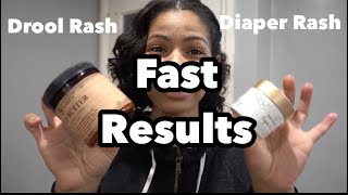 How to Get Rid of Baby Skin Rash FAST & Natural | Drool Rash