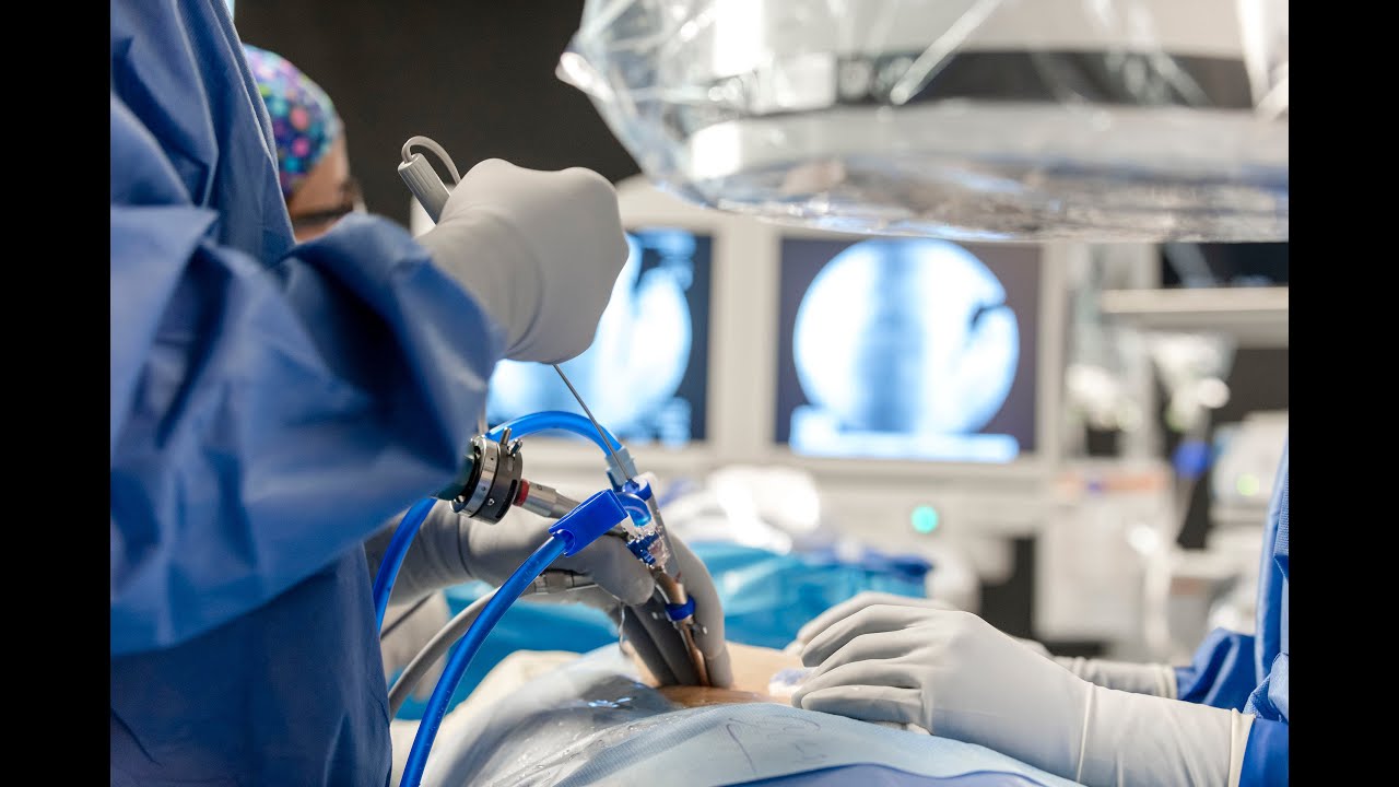 What Is Endoscopic Spine Surgery? | Dr. Faraz A Syed | Alleviate Pain Management Center | India|