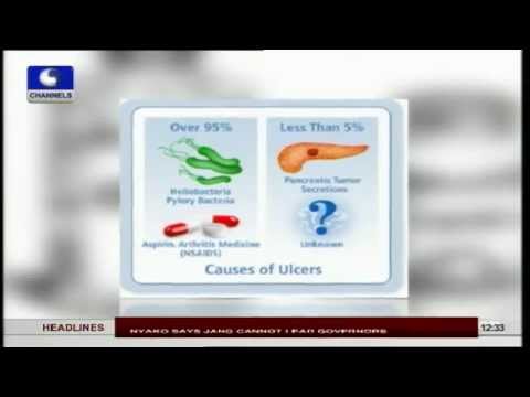 Causes of Peptic Ulcers  PT1