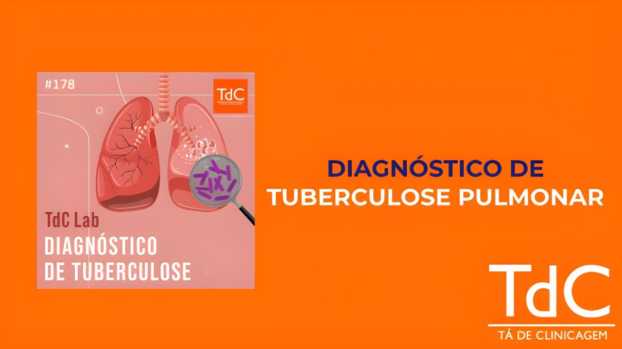 Tuberculose pulmonar e extrapulmonar: Como diagnosticar?