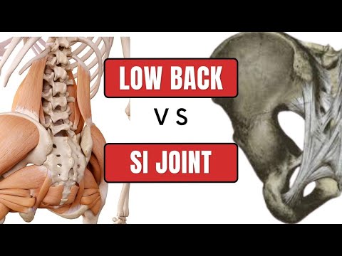 Low Back Pain: Is it from Your SI Joint or Low Back?