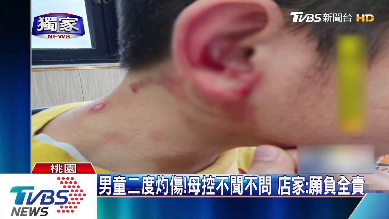 店家上菜不慎打翻 小男童遭熱咖哩淋身