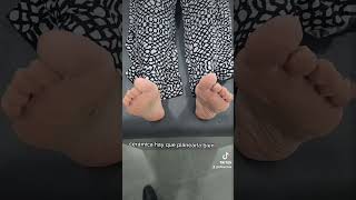 #artroplastiadecadera por #artrosis