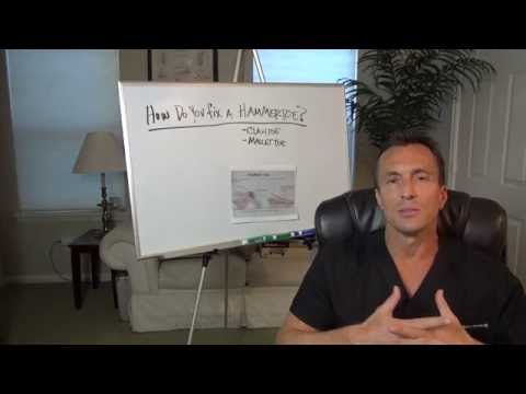 Ask Dr Moore Foot and Ankle FAQ Frequently Asked Questions Video Offering