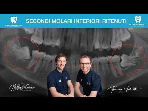 Francesco Martinetti-14