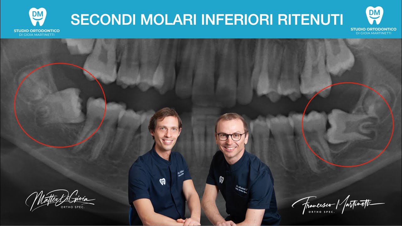 Francesco Martinetti-14