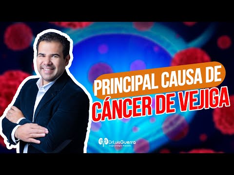 Principal Causa del Cáncer de Vejiga